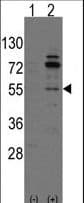 IHC-plus™ Polyclonal Rabbit anti-Rat ARHGEF9 / Collybistin Antibody (aa274-303, IHC, WB)