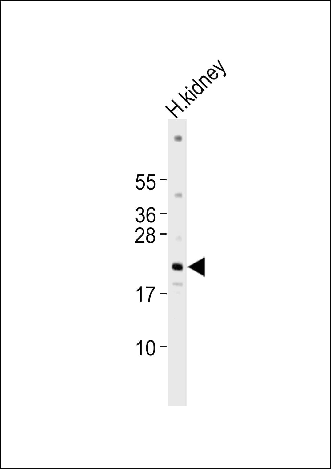 Polyclonal Rabbit anti-Human PPP1R14D / CPI17-Like Antibody (WB)