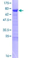 Human RBM17 Protein (Recombinant GST)