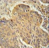 PSMD7 / MOV34 Antibody (aa267-295)