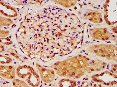 Polyclonal Rabbit anti-Human ZKSCAN5 Antibody (IHC)