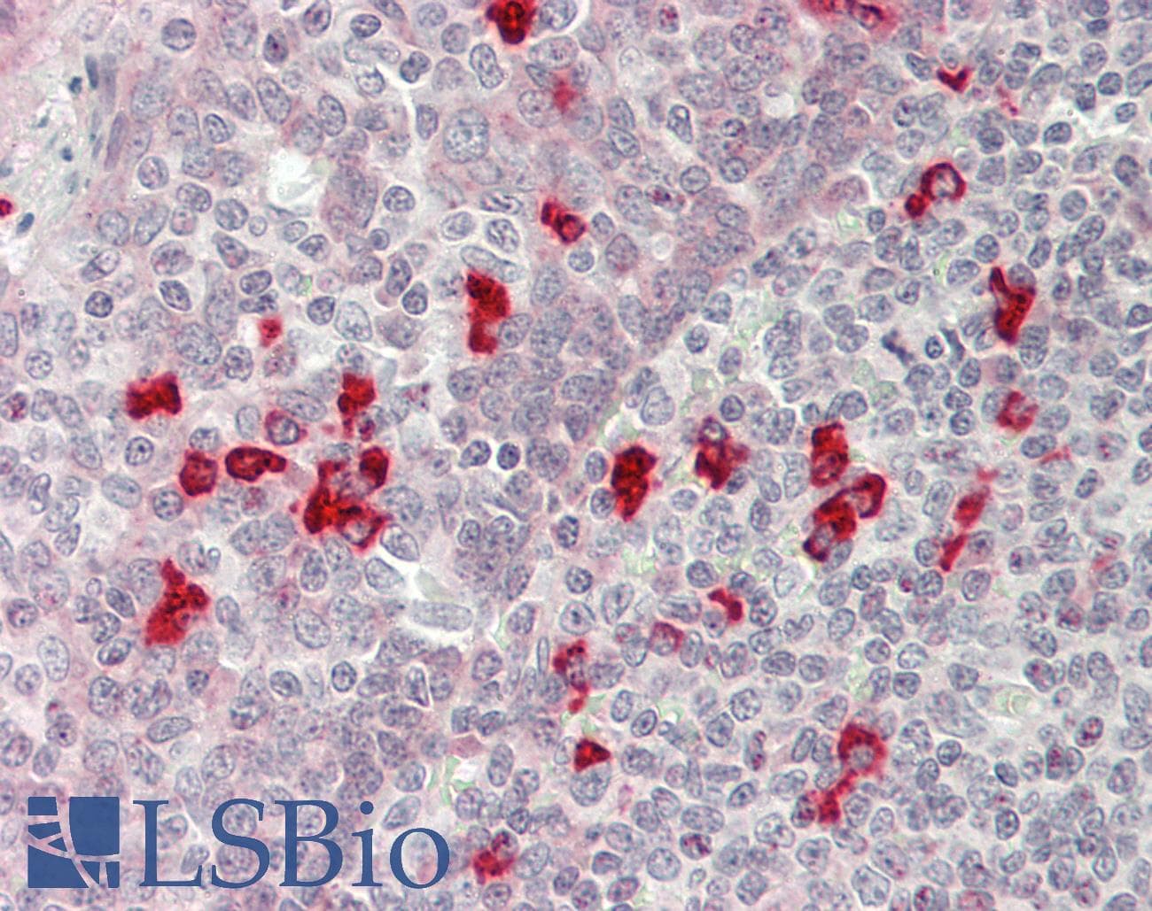 IHC-plus™ BTG1 Antibody (aa92-118)