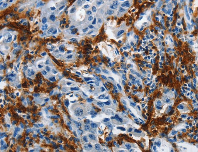 Polyclonal Rabbit anti-Human IL20RA Antibody (IHC)
