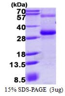 Human RGS17 / RGSZ2 Protein (Recombinant His)