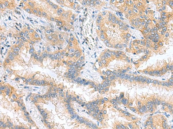 RPS16 / Ribosomal Protein S16 Antibody