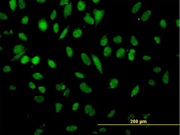 Monoclonal Mouse anti-Human NFX1 Antibody (clone 1D12, IF, WB)
