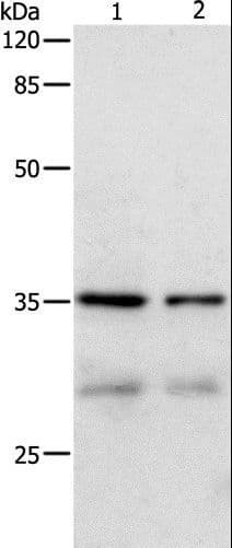 Polyclonal Rabbit anti-Human CDK4 Antibody (IHC, WB)