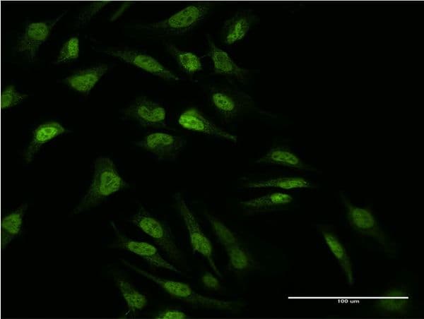 MAP2K2 / MKK2 / MEK2 Antibody (clone 8D10)