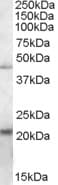 ERP44 Antibody (aa168-180)