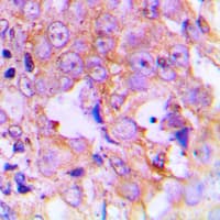 EEF2 / Elongation Factor 2 Antibody (N-Terminus)