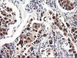 FBXO21 Antibody (clone OTI3C11, Carrier-free)