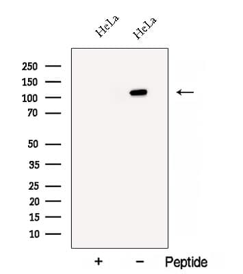Polyclonal Rabbit anti-Human BRD8 Antibody (WB)
