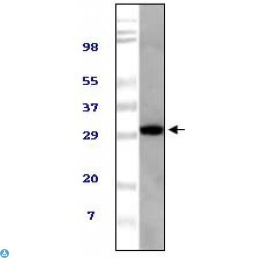 UBXD9 / ASPL Antibody