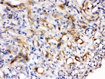 NES / Nestin Antibody