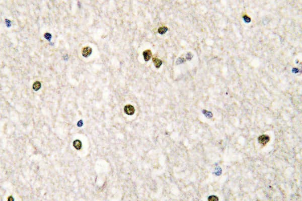 MED17 / TRAP80 Antibody (Val171)