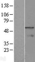 CPEB1 / CPEB Protein (Over-Expression Lysate Myc-DDK (Flag))