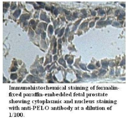 PELI3 / Pellino 3 Antibody (aa52-299)