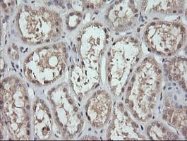 MAP2K3 / MEK3 / MKK3 Antibody (clone OTI5G5)