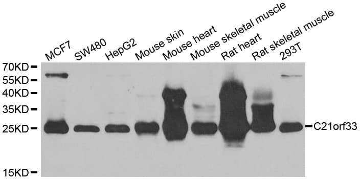 Polyclonal Rabbit anti-Human GT335 / ES1 Antibody (IHC, IF, WB)