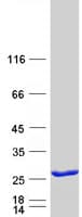 Human RALB Protein (Recombinant Myc-DDK (Flag))