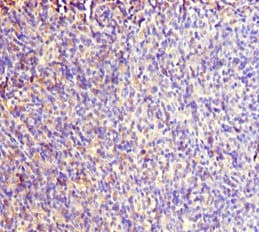 RACGAP1 / MGCRACGAP Antibody