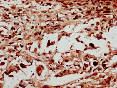Polyclonal Rabbit anti-Human MMS21 / NSMCE2 Antibody