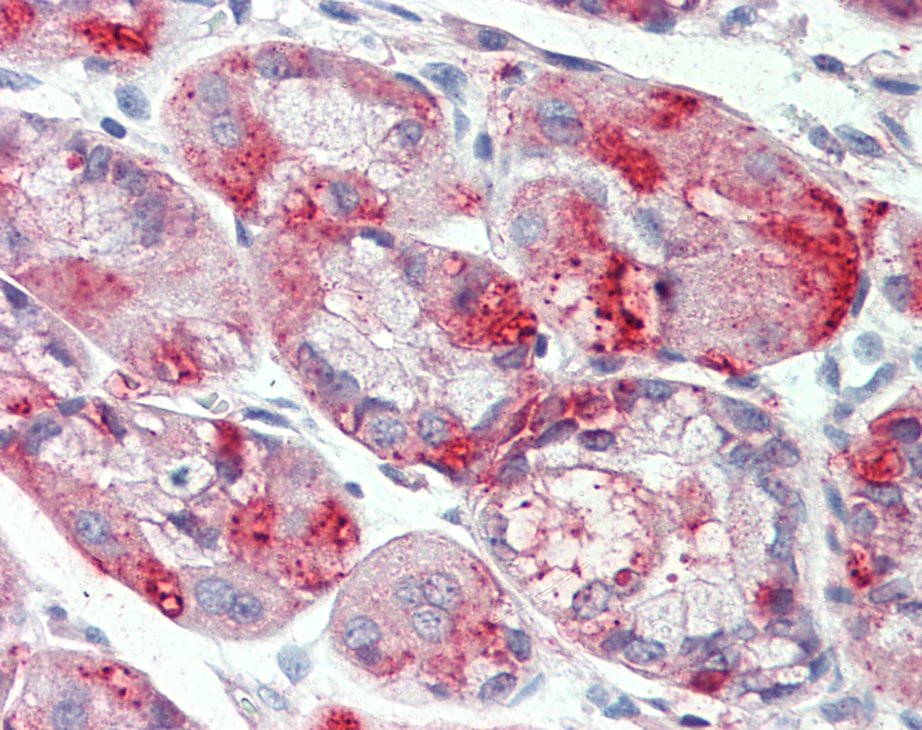 IHC-plus™ SLC12A2 / NKCC1 Antibody (N-Terminus)