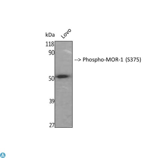 Polyclonal Rabbit anti-Human OPRM1 / Mu Opioid Receptor Antibody (IHC, WB)