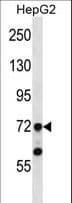 Polyclonal Rabbit anti-Human TAFII70 / TAF6 Antibody (aa24-53, WB)