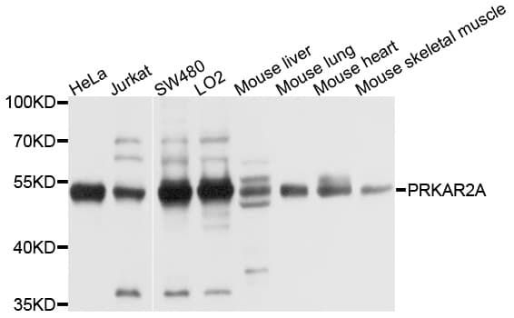 PRKAR2A Antibody