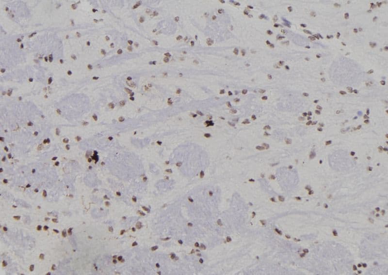 SUMO4 Antibody