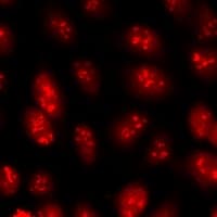 NF45 / ILF2 Antibody