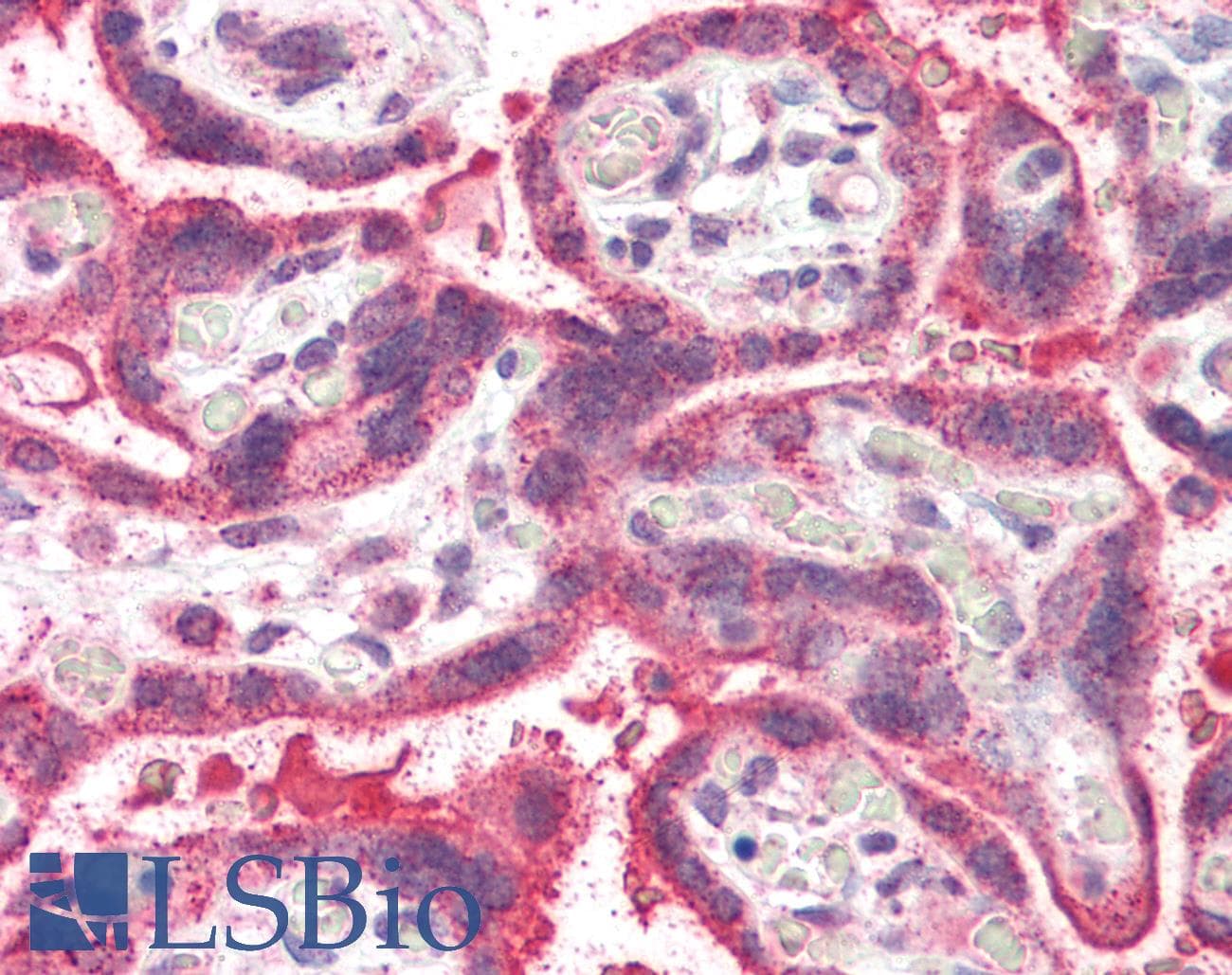 IHC-plus™ Polyclonal Goat anti-Human NEIL1 Antibody (aa378-390, IHC)