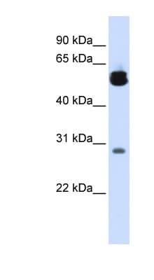 YWHAZ / 14-3-3 Zeta Antibody (C-Terminus)
