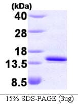 Human FKBP1A / FKBP12 Protein (Recombinant His)