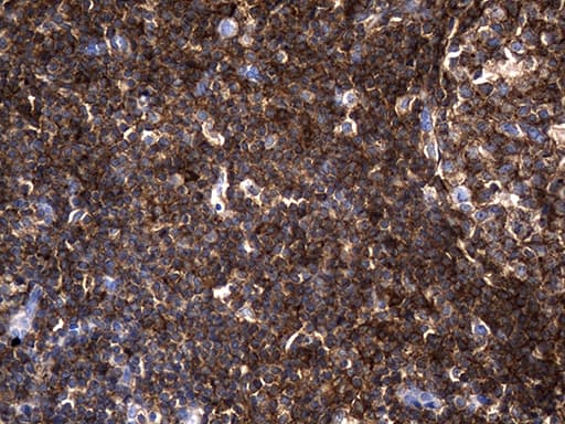 AQP8 / Aquaporin 8 Antibody (clone OTI1C10)