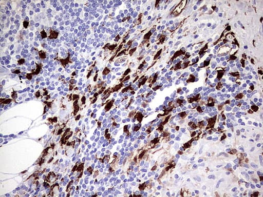 S100A9 / MRP14 Antibody (clone UMAB173)