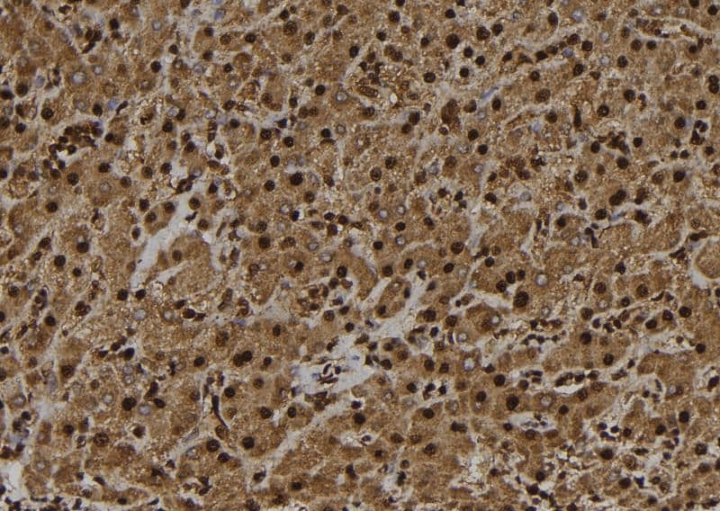UBE3B Antibody