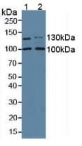 COL1A2 / Collagen I Alpha 2 Antibody (aa1109-1372)