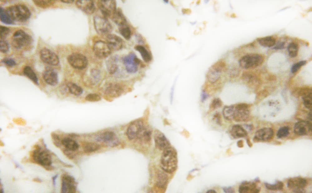 TP53 / p53 Antibody (phospho-Ser366)