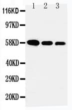 Polyclonal Rabbit anti-Human AHSG / Fetuin A Antibody (aa46-62, WB)