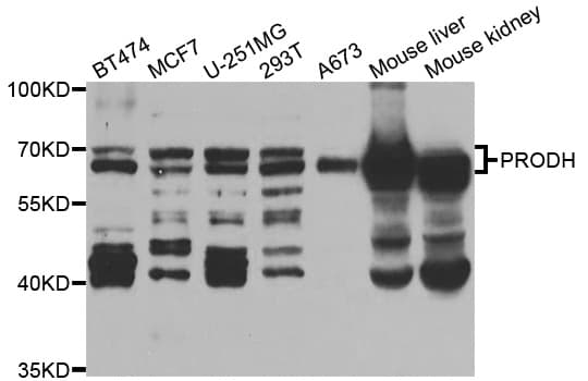 IHC-plus™ PRODH Antibody