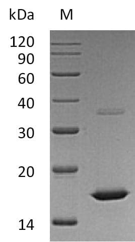 Human FGF2 / Basic FGF Protein (Recombinant)