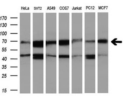 RUNX1T1 / ETO Antibody (clone OTI1H1)