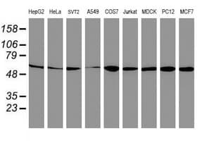 AKT1 Antibody (clone OTI3E3)