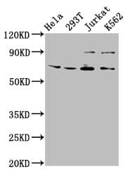 ALG9 Antibody