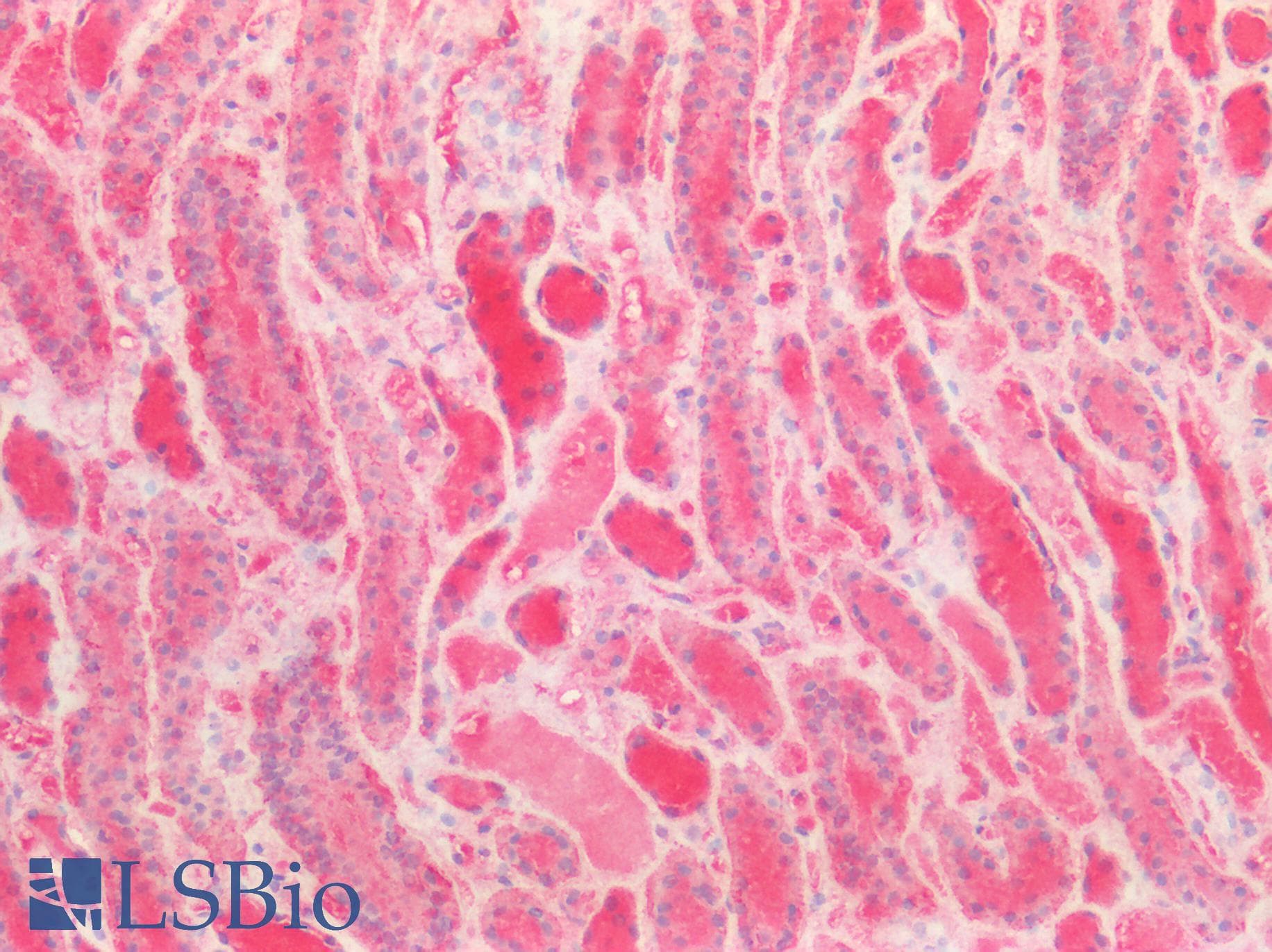 PLCL2 Antibody