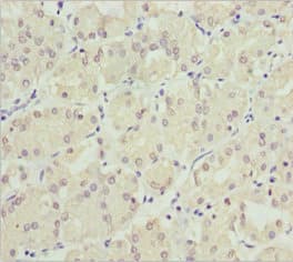 Polyclonal Rabbit anti-Human NEK8 Antibody (IHC)