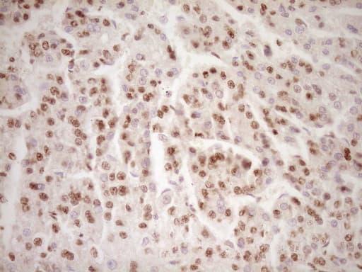 LPIN1 / Lipin 1 Antibody (clone OTI8F10)
