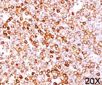 CD79A / CD79 Alpha Antibody (aa202-216, clone HM47/A9, Azide-free, BSA-free)